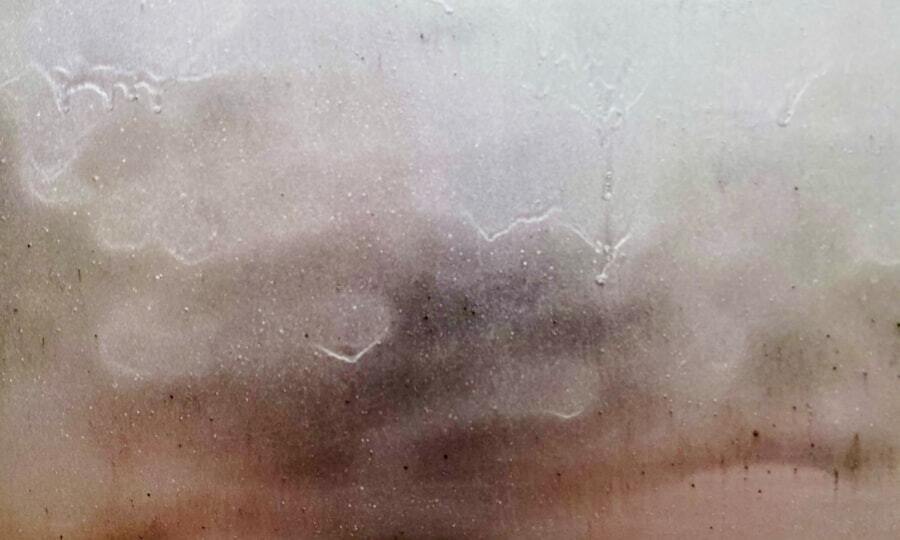 Foto multiple sclerose